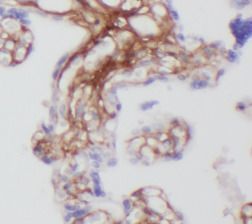 CXorf61 antibody