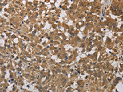 CYB5A Antibody
