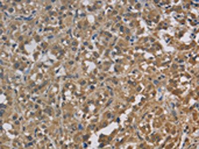 CYB5A Antibody