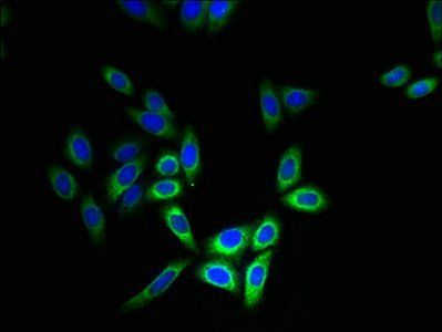 CYB5B Antibody