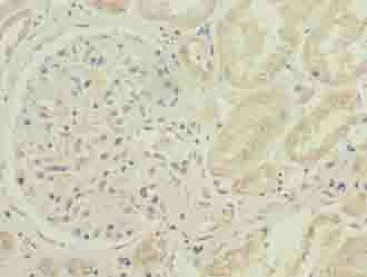 CYB5B Antibody