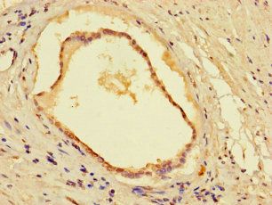 CYB5R1 antibody