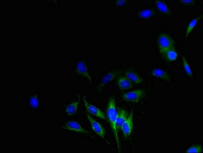 CYBB antibody