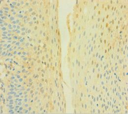 CYBB Antibody