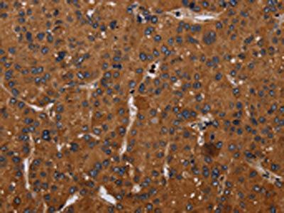 CYBB Antibody