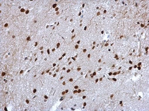 Cyclin T2 antibody [C2C3], C-term