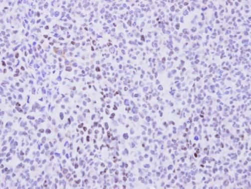 Cyclin T2 antibody [C2C3], C-term