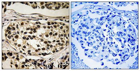 Cyclin C (Phospho-Ser275) Antibody