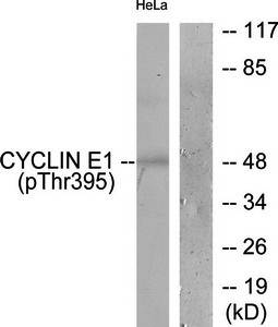 Cyclin E1 (Phospho-Thr395) Antibody
