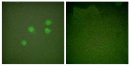 Cyclin E1 Antibody