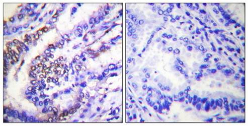 Cyclin E1 Antibody