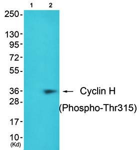 Cyclin H (Phospho-Thr315) Antibody