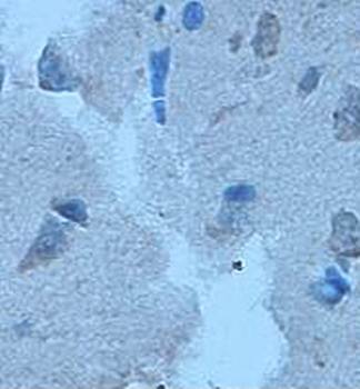 Cyclin D1 Rabbit Polyclonal Antibody