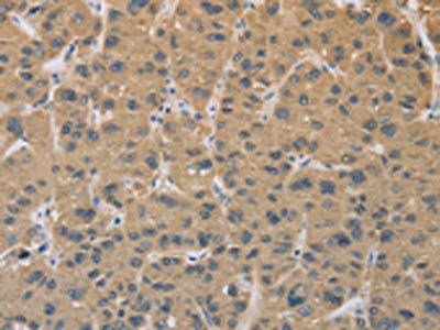 CYFIP2 Antibody