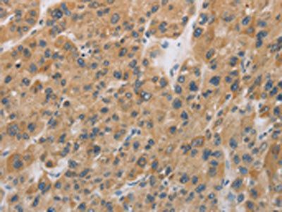 CYFIP2 Antibody