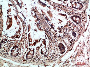 CYFIP2 Antibody