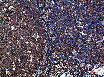 CYFIP2 Antibody