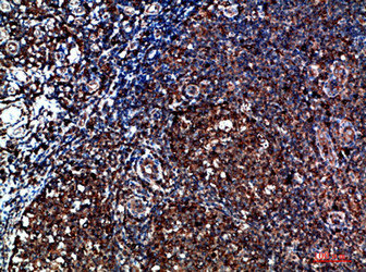 CYFIP2 Antibody
