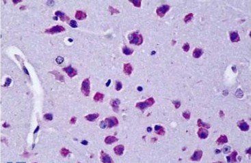 Goat anti-Cyld (mouse) Antibody