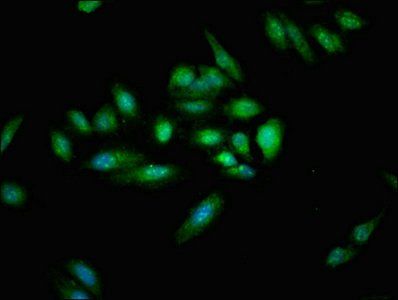 CYLD Antibody