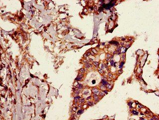 CYLD Antibody