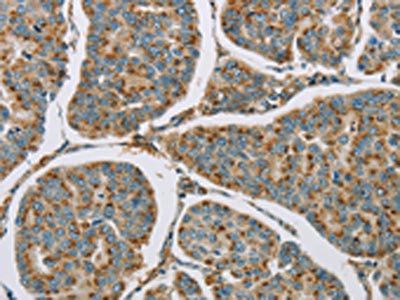 CYP11B1 Antibody