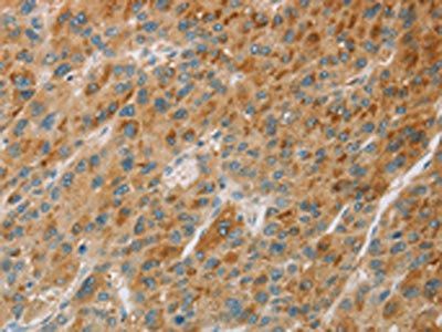 CYP11B1 Antibody