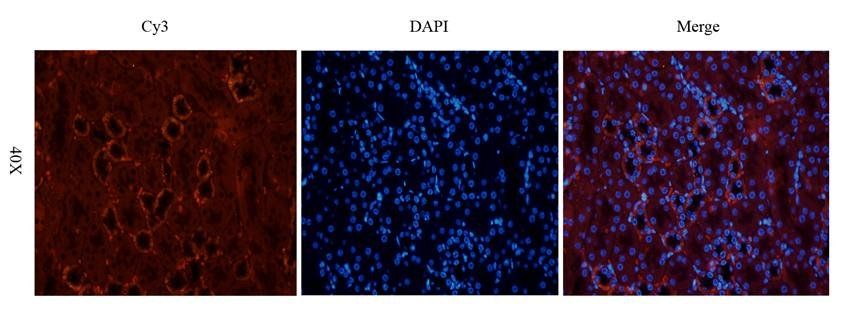 CYP11B1 antibody