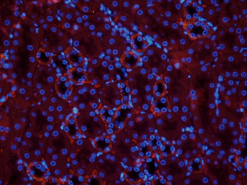 CYP11B1 antibody