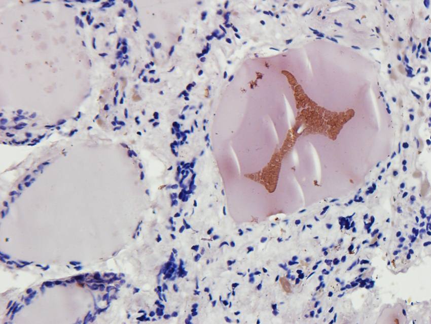 CYP11B1 antibody