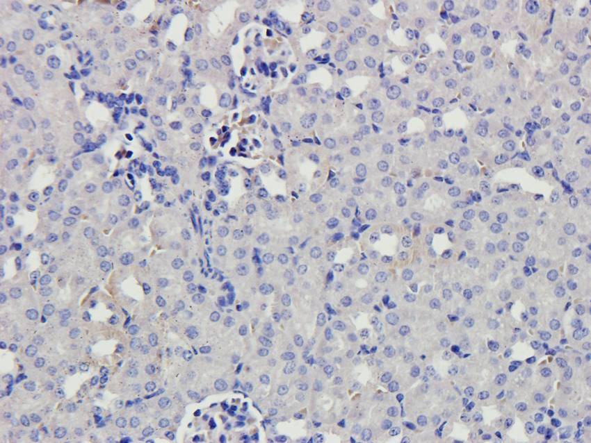 CYP11B1 antibody