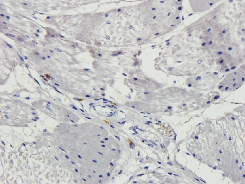 CYP11B1 antibody