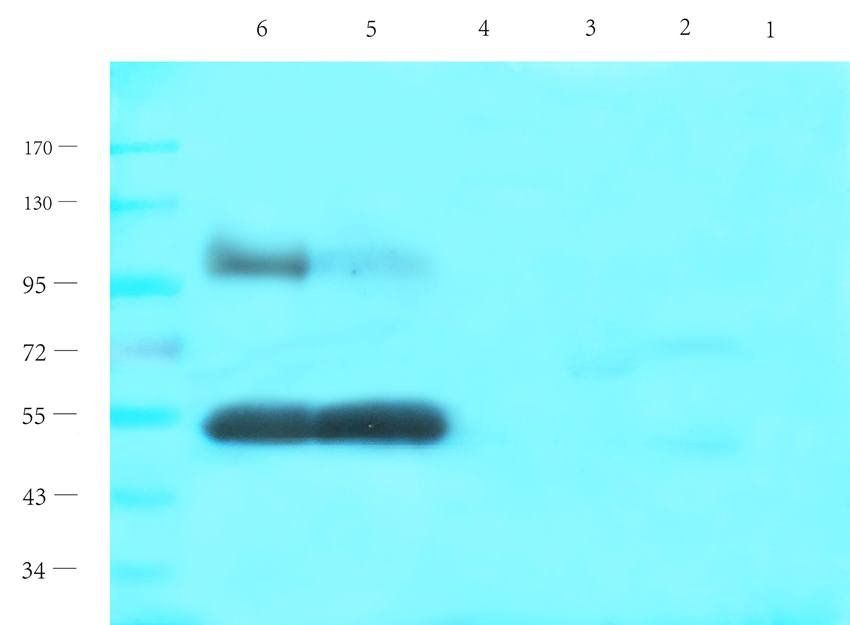 CYP11B1 antibody