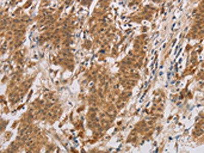 CYP17A1 Antibody