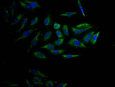 CYP17A1 Recombinant Monoclonal Antibody