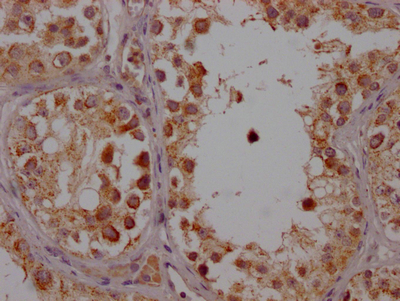 CYP17A1 Recombinant Monoclonal Antibody