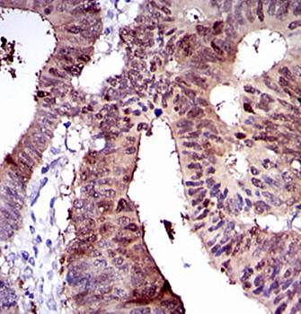 CYP1A1 Antibody