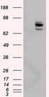 CYP21A2 Antibody