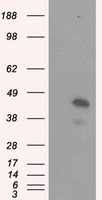 CYP21A2 Antibody
