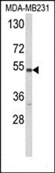 CYP2A13 antibody