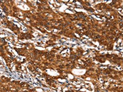 CYP2D6 Antibody