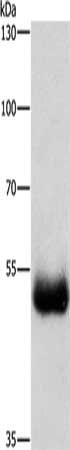 CYP2D6 Antibody