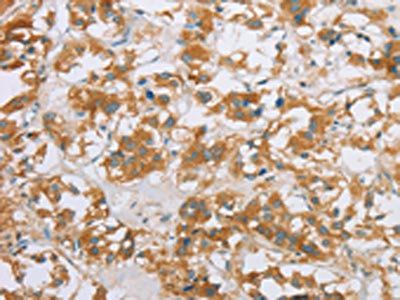 CYP2E1 Antibody