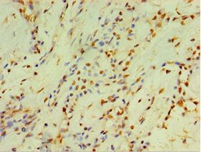 CYP2J2 Antibody