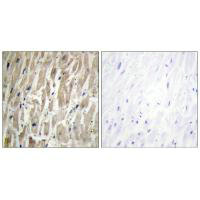 CYP2J2 Antibody