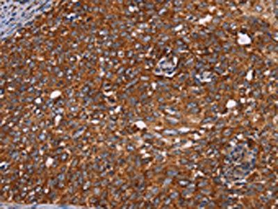 CYP2W1 Antibody