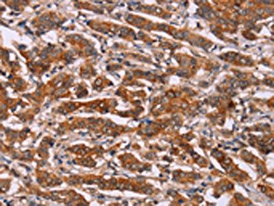 CYP2W1 antibody