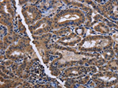 CYP3A4 Antibody