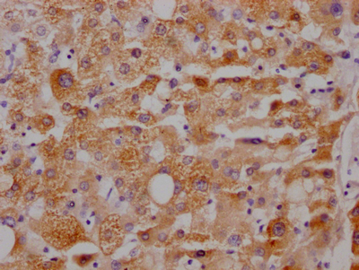 CYP3A4 Recombinant Monoclonal Antibody