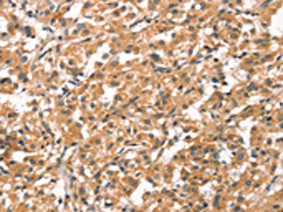 CYP46A1 Antibody